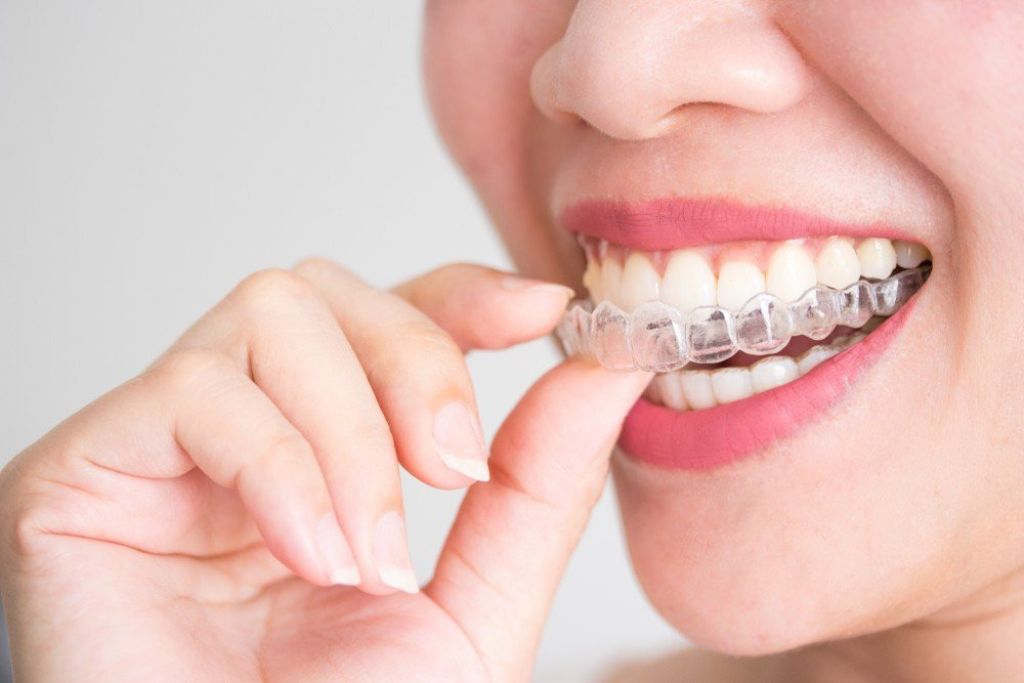 Ortodoncia Invisible Invisalign en Beniel | De la Torre Clínica Dental