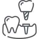 Implantes Dentales Beniel | De la Torre Clínica Dental