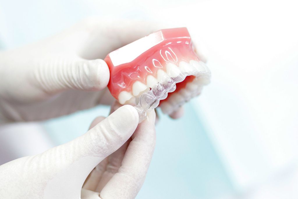 Ortodoncia Invisible en Beniel | De la Torre Clínica Dental