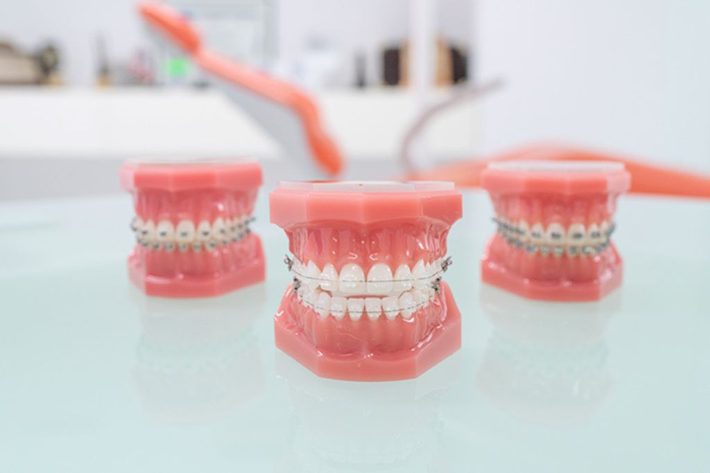 Ortodoncista en Beniel | Clínica Dental de la Torre