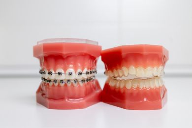 Ortodoncia Beniel | De la Torre Clínica Dental