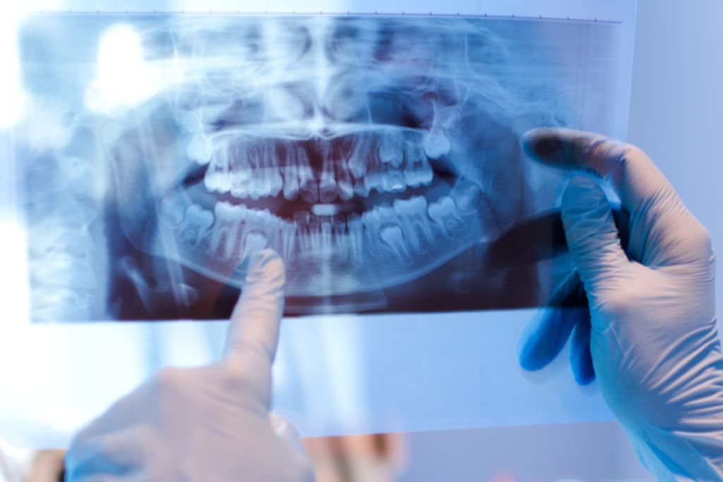 Cirugía Oral en Beniel | De la Torre Clínica Dental